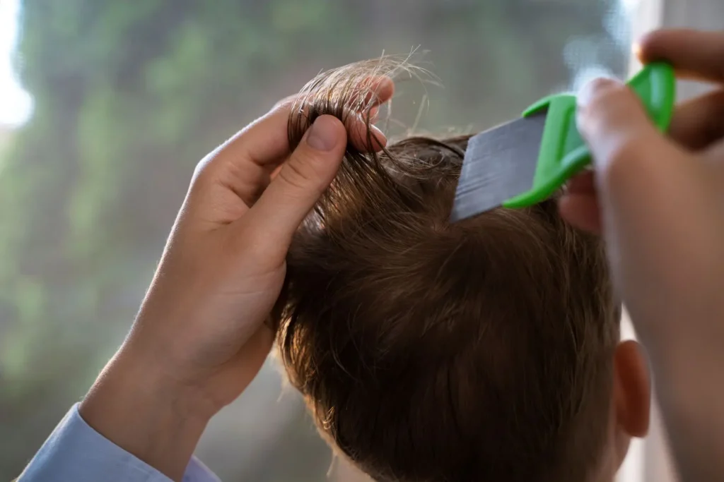Tratamiento para piojos y liendres: cómo eliminarlos