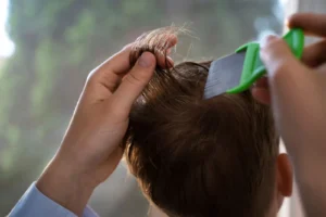 Tratamiento para piojos y liendres: cómo eliminarlos